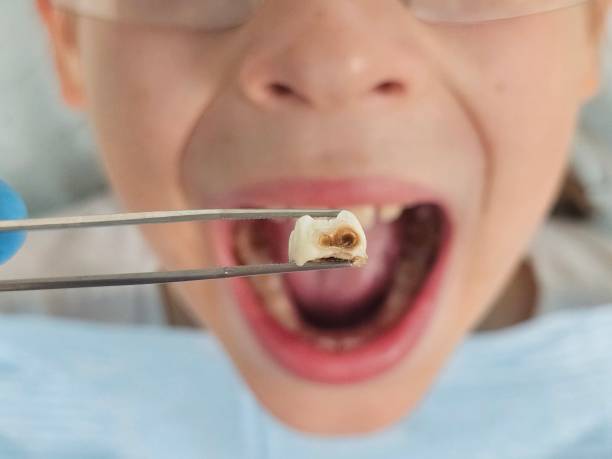 Best Tooth Pain Emergency Relief  in Berly, MO